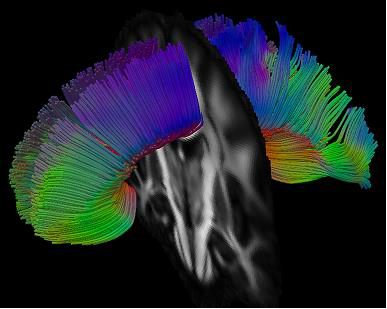 Transforming Clinical Brain Science